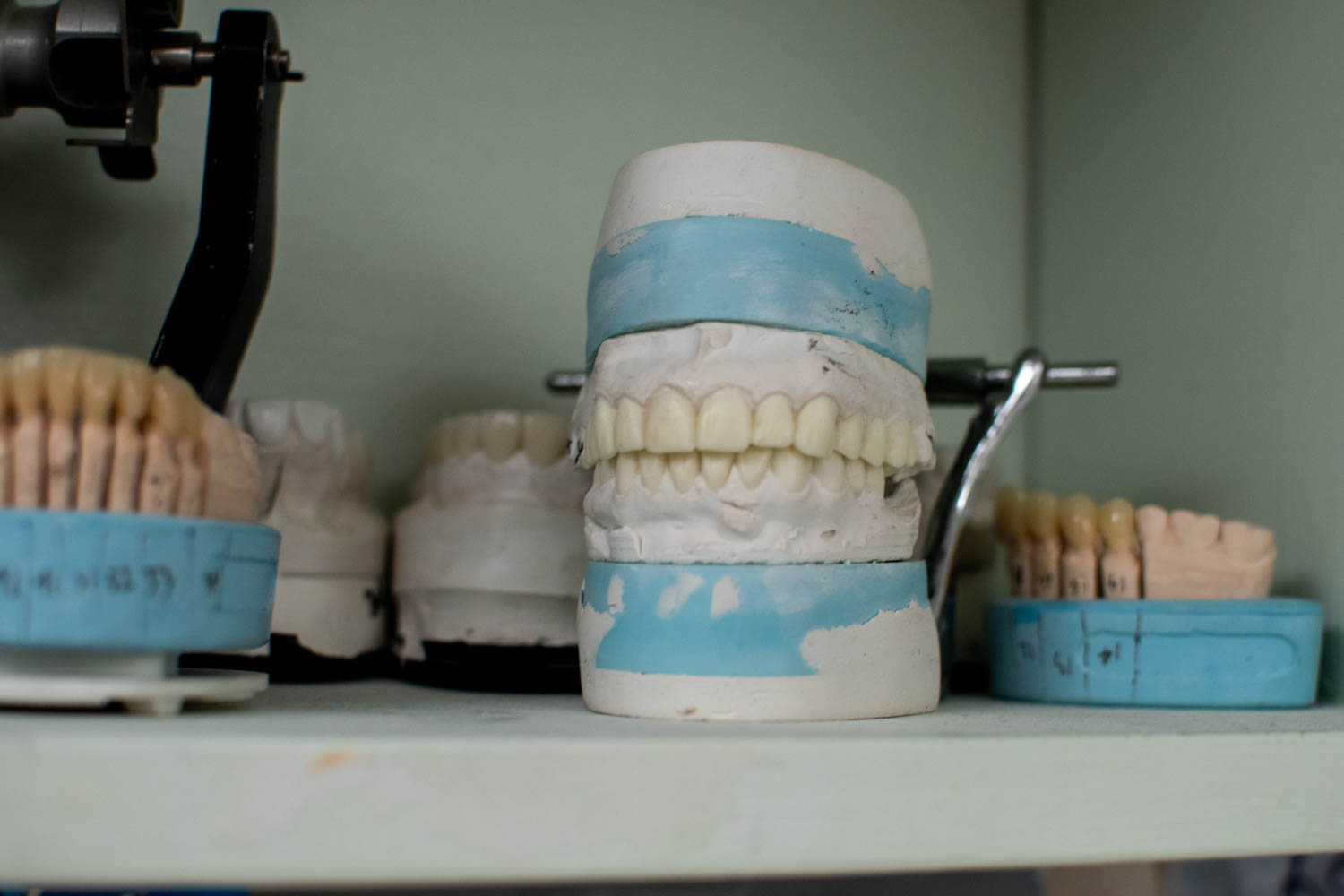 Dental Implants at Small Dental