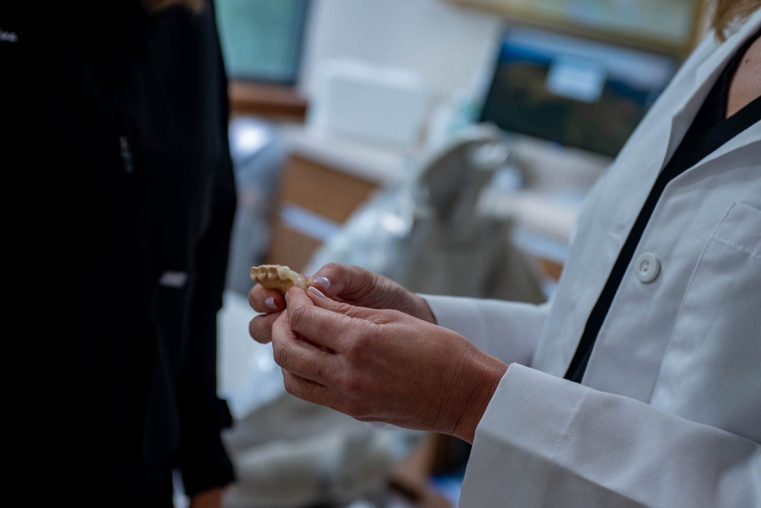 Porcelain Veneers at Small Dental